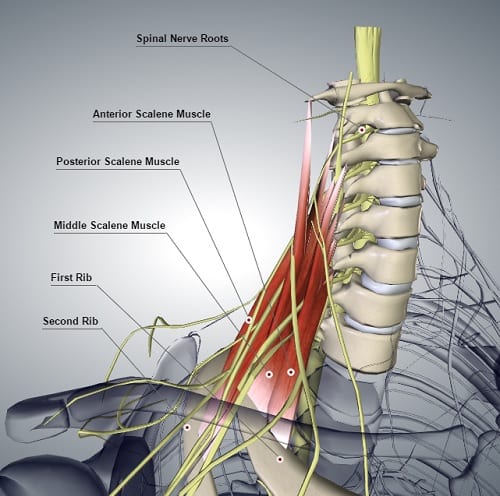 Computer graphic of the scalene muscle group showing spinal nerve roots.