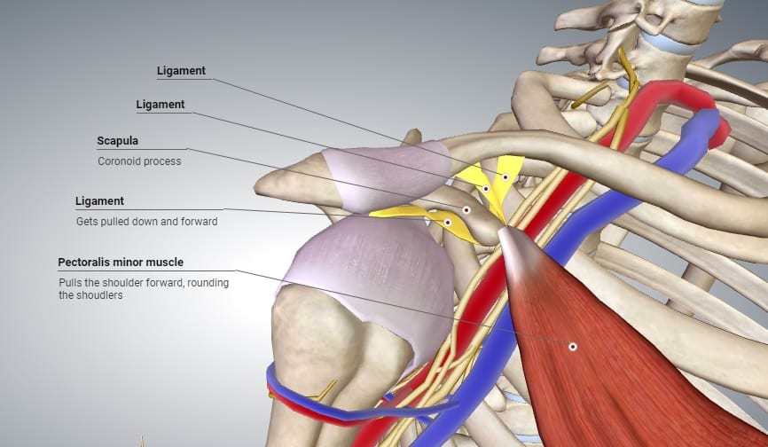 What is Thoracic Outlet Syndrome? – James Maddock at The Urban