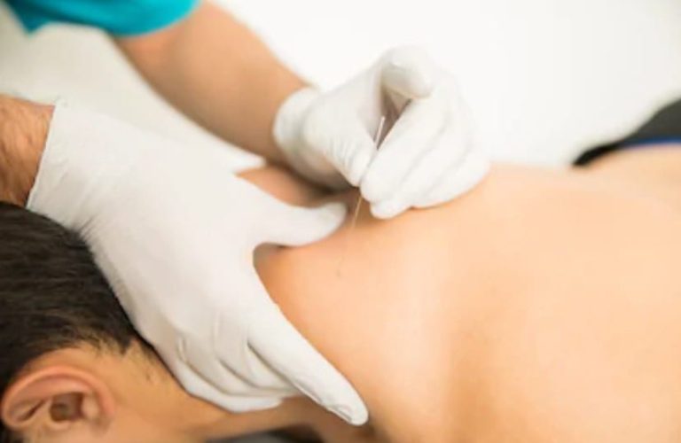 Why Myotherapy Is About To End Remedial Massage